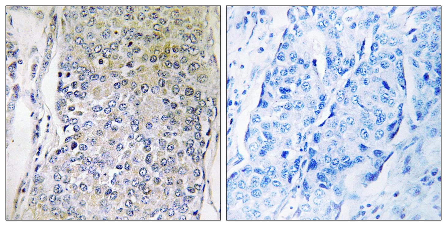 CPXM2 Antibody
