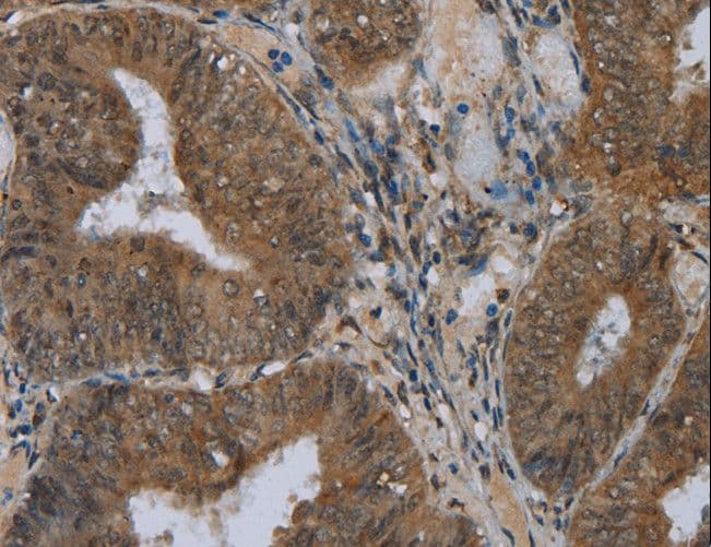 NAT10 Antibody