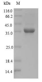 Mouse NKX3-2 / BAPX1 Protein (Recombinant)