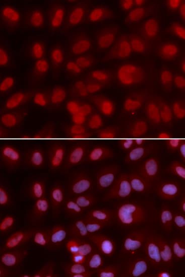 SIN3A Antibody (aa1-120)