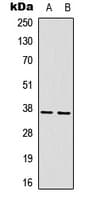 Polyclonal Rabbit anti-Human ART1 /CD296 Antibody (Internal, WB)