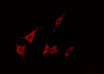 FNTB Antibody