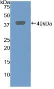 Rat MIP2 / GRO2 / CXCL2 Protein (Recombinant His-GST, N-terminus)