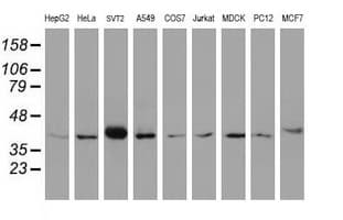 Monoclonal Mouse anti-Human Alpha4GnT / A4GNT Antibody (clone OTI1F7, aa121-340, WB)
