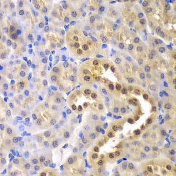 Polyclonal Rabbit anti-Human GLO1 / Glyoxalase I Antibody (IHC, IF, WB)