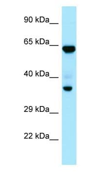 PPP1CC / PP1 Gamma Antibody (C-Terminus)