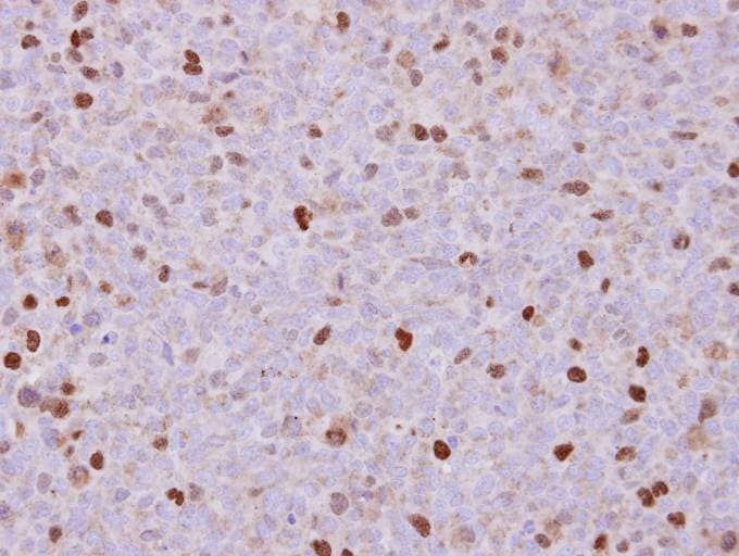 RACGAP1 / MGCRACGAP Antibody (aa1-202)