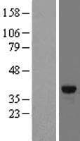 FN3K / Fructosamine-3-Kinase Protein (Over-Expression Lysate Myc-DDK (Flag))