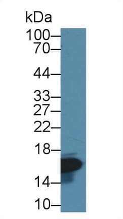 I-FABP / FABP2 Antibody (aa2-132)
