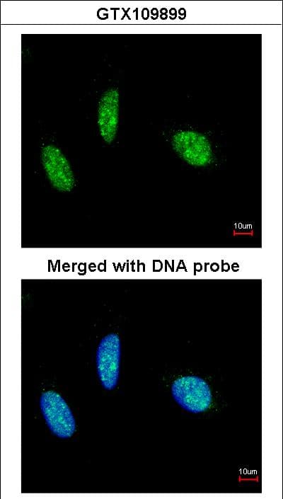 RBM15 Antibody (aa146-425)