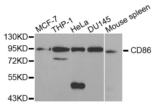 IHC-plus™ Polyclonal Rabbit anti-Human CD86 Antibody (IHC, IF, WB)