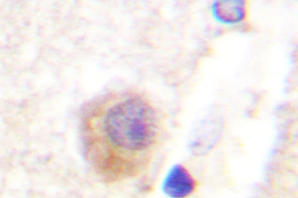 Polyclonal Rabbit anti-Human RPH3A / Rabphilin 3A Antibody (Pro231, IHC, IF, WB)