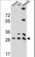 Polyclonal Rabbit anti-Human PGAM4 Antibody (aa25-53, IHC, WB)