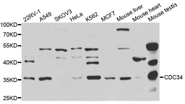 IHC-plus™ Polyclonal Rabbit anti-Human CDC34 Antibody (IHC, IF, WB)