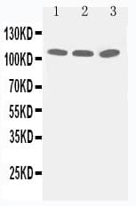 Polyclonal Rabbit anti-Human TJP3 / ZO3 Antibody (aa913-933, WB)