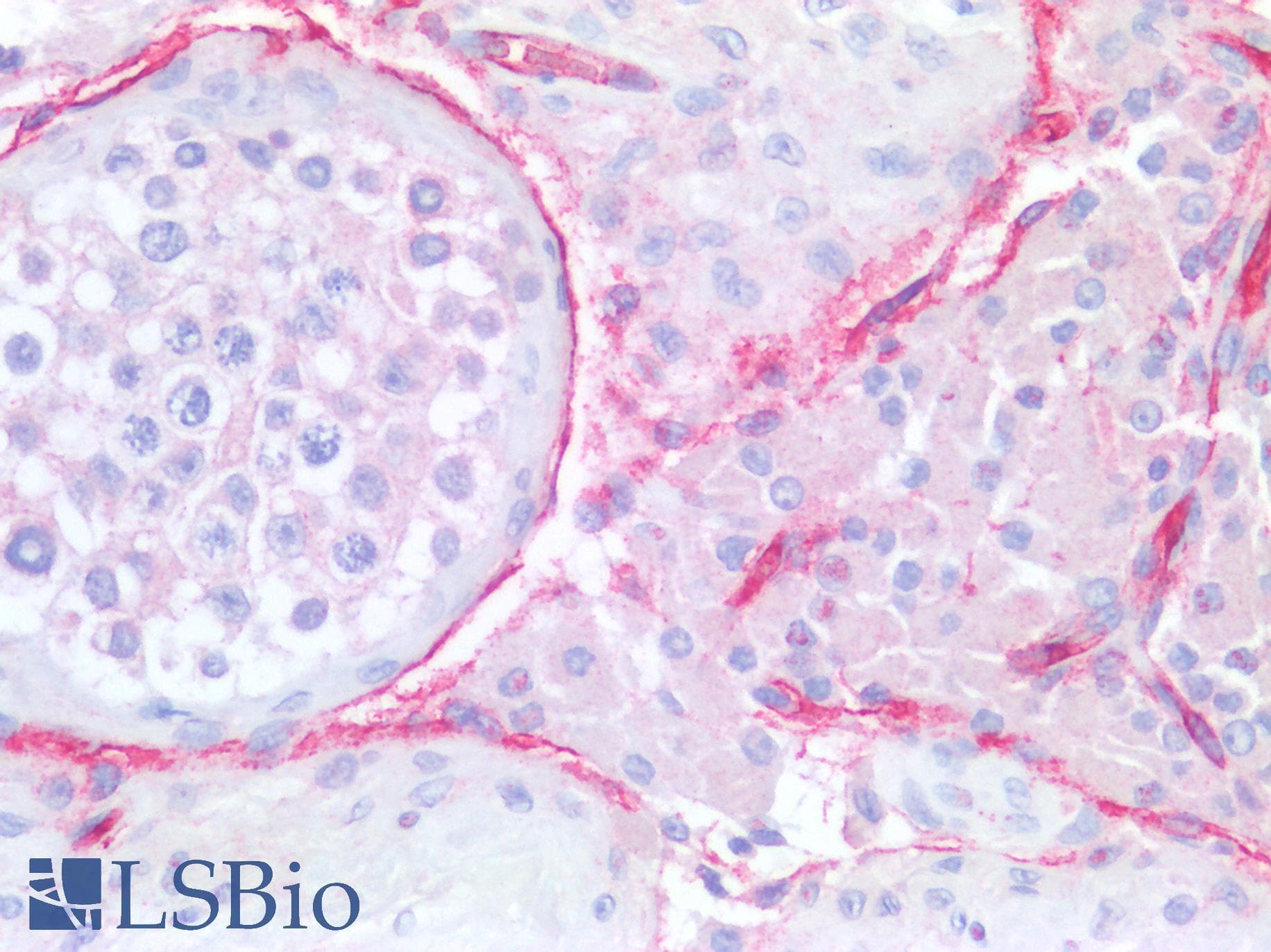 Monoclonal Mouse anti-Human CD34 Antibody (IHC, WB)