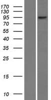 RNF6 Protein (Over-Expression Lysate Myc-DDK (Flag))