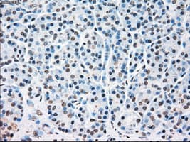 Monoclonal Mouse anti-Human STK3 Antibody (clone OTI2D4, IHC, WB)