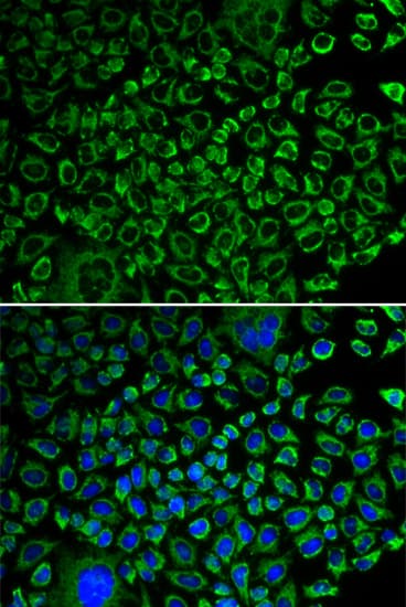 Polyclonal Rabbit anti-Human F10 / Factor X Antibody (IF, WB)