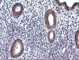 CTAG1B / NY-ESO-1 Antibody (clone OTI5A5)