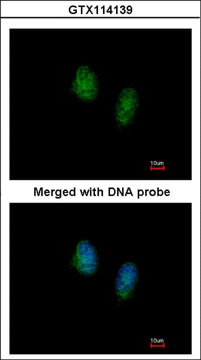 RAN Antibody