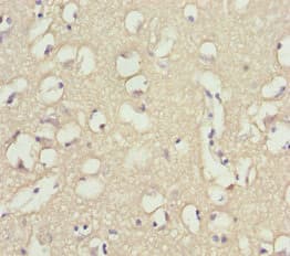 Polyclonal Rabbit anti-Human INPP4A Antibody (IHC, WB)