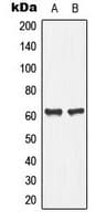 Polyclonal Rabbit anti-Human PLA2G4C Antibody (Internal, WB)