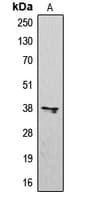 CXCR3 Antibody (Internal)