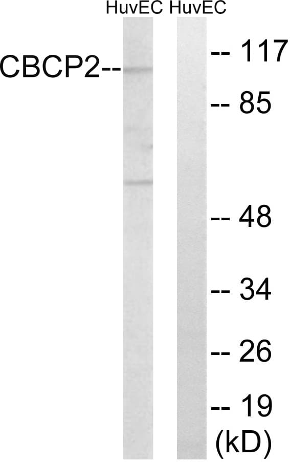 Polyclonal Rabbit anti-Human AGBL2 / CCP2 Antibody (aa731-780, IHC, WB)