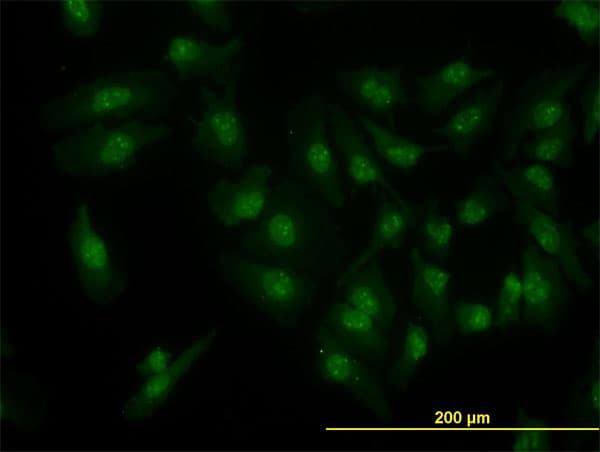 IHC-plus™ CDK6 Antibody (clone 8H4)