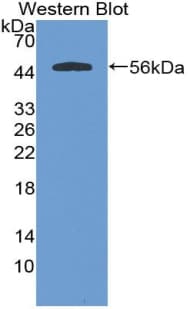 Cystatin SA / CST2 Antibody (aa21-141)
