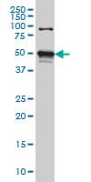 STK38 Antibody (clone 3A5)