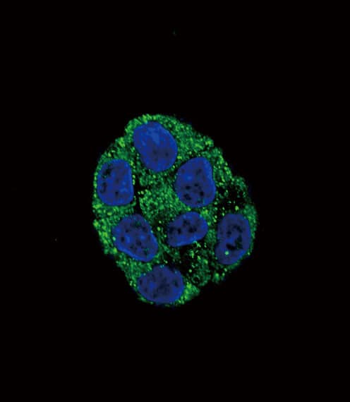 Polyclonal Rabbit anti-Human PLA2G6 / IPLA2 Antibody (aa551-580, IHC, IF, WB)