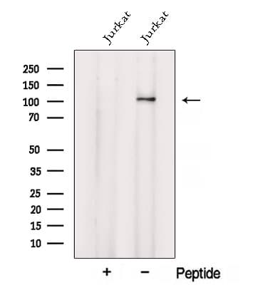 Polyclonal Rabbit anti-Human VARS / ValRS Antibody (WB)