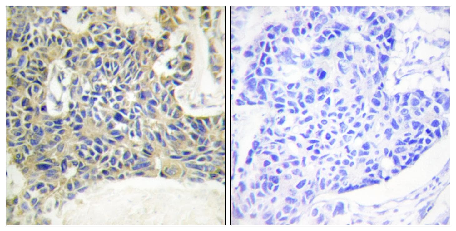 PRKCQ / PKC-Theta Antibody (phospho-Ser695)