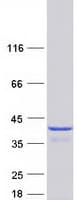 Human TRP32 / TXNL1 Protein (Recombinant Myc-DDK (Flag))