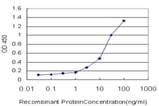 IHC-plus™ ACP1 / Acid Phosphatase Antibody (clone 4B10)