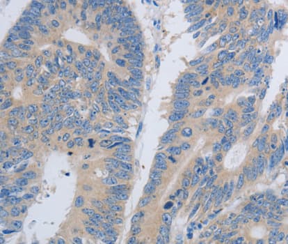 PAWR / PAR4 Antibody