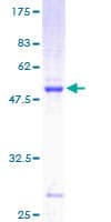 Human RAB29 / RAB7L1 Protein (Recombinant GST)