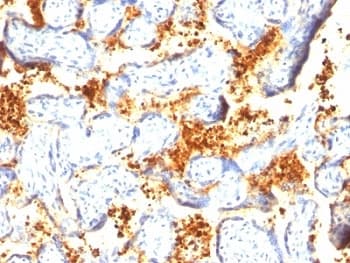 TGM2 / Transglutaminase 2 Antibody (clone TGM2/419)