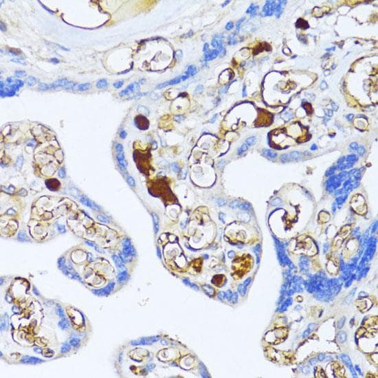 A2M / Alpha-2-Macroglobulin Antibody
