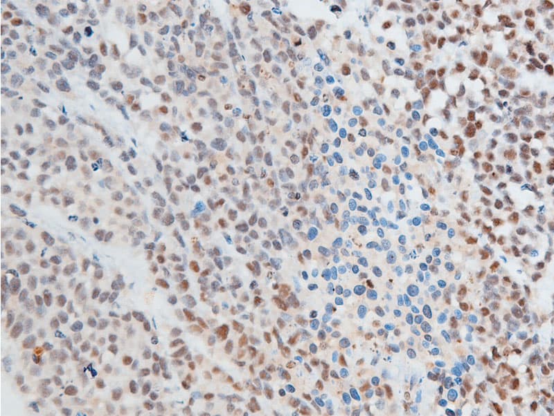 CHEK2 / CHK2 Antibody (phospho-Thr387)