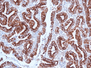MUC5AC Antibody (clone CLH2)