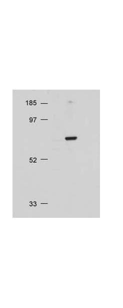 AKT1 + AKT2 + AKT3 Antibody (aa460-480)