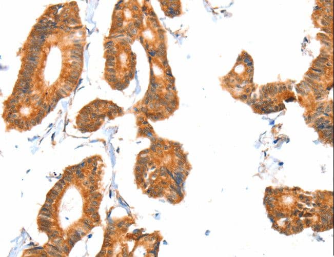 ACOX1 / ACOX Antibody