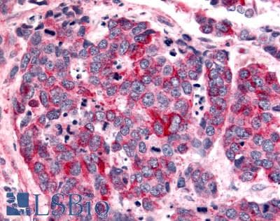 PathPlus™ ADGRB2 / BAI2 Antibody (N-Terminus)