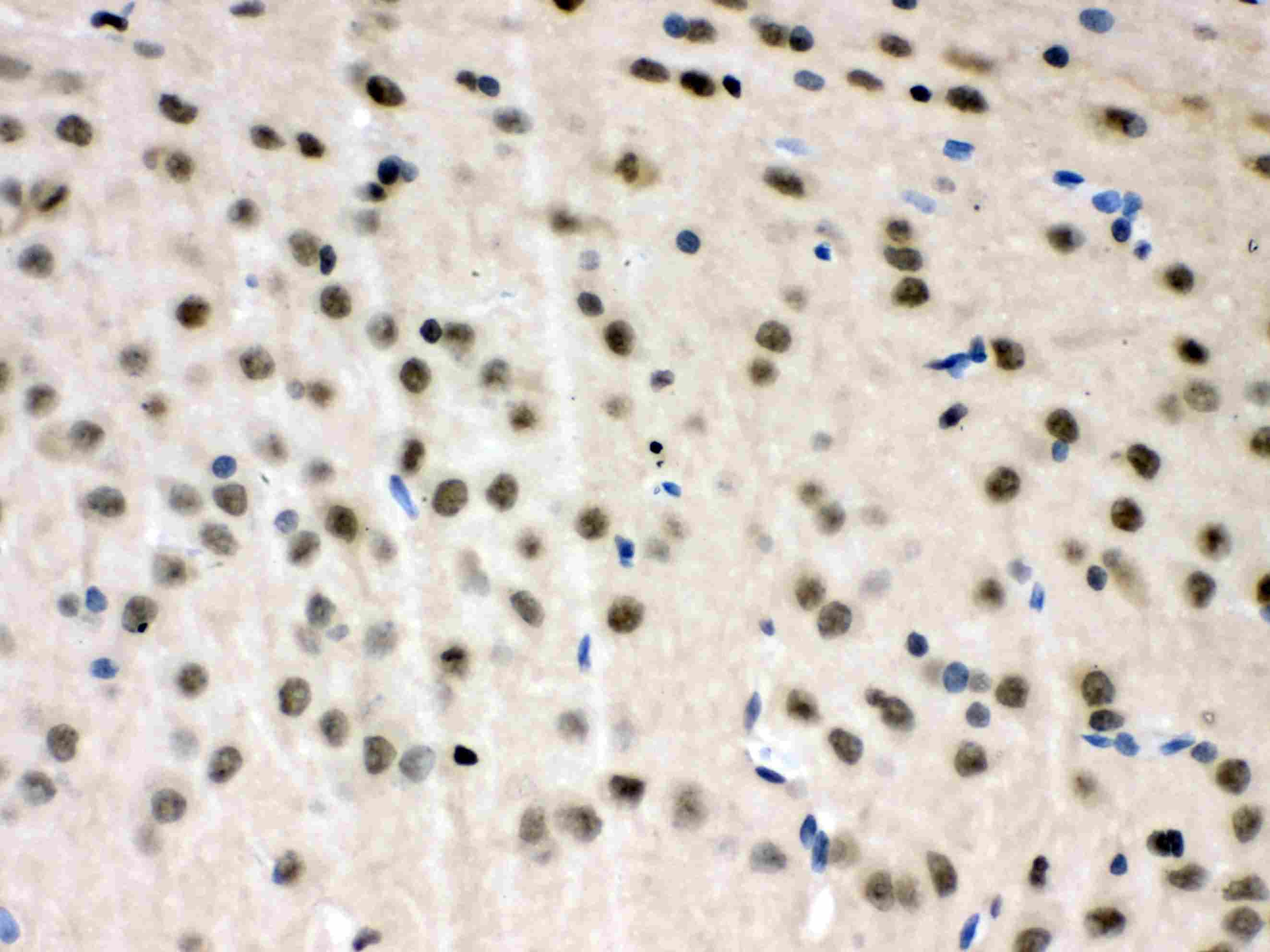 Polyclonal Rabbit anti-Human VCP Antibody (IHC, WB)