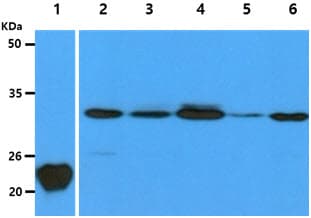 CAPNS1 / CAPN4 Antibody (clone AT1D11)