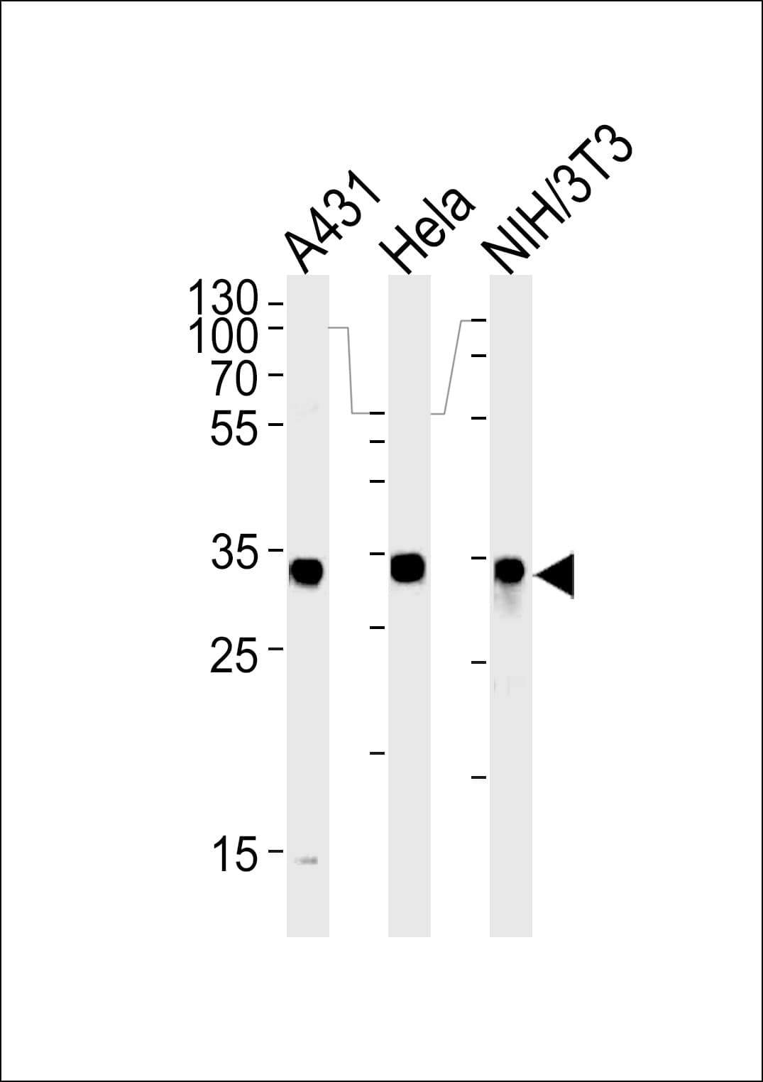 Polyclonal Rabbit anti-Human MDH / MDH2 Antibody (aa86-115, IHC, WB)