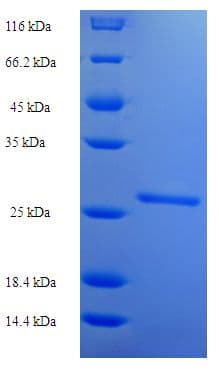 Human TSHB / TSH-Beta Protein (Recombinant His-SUMO)